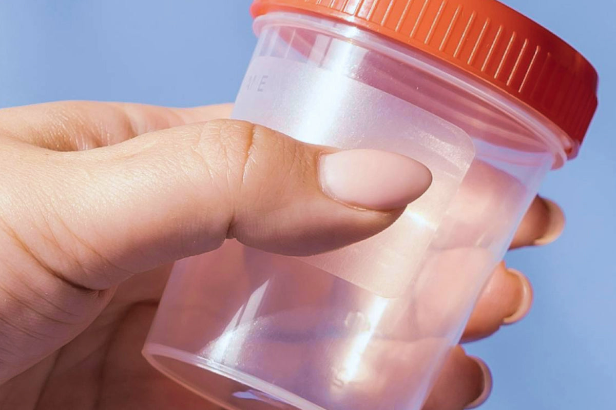 Saliva vs urine drug test kits: What’s the difference?