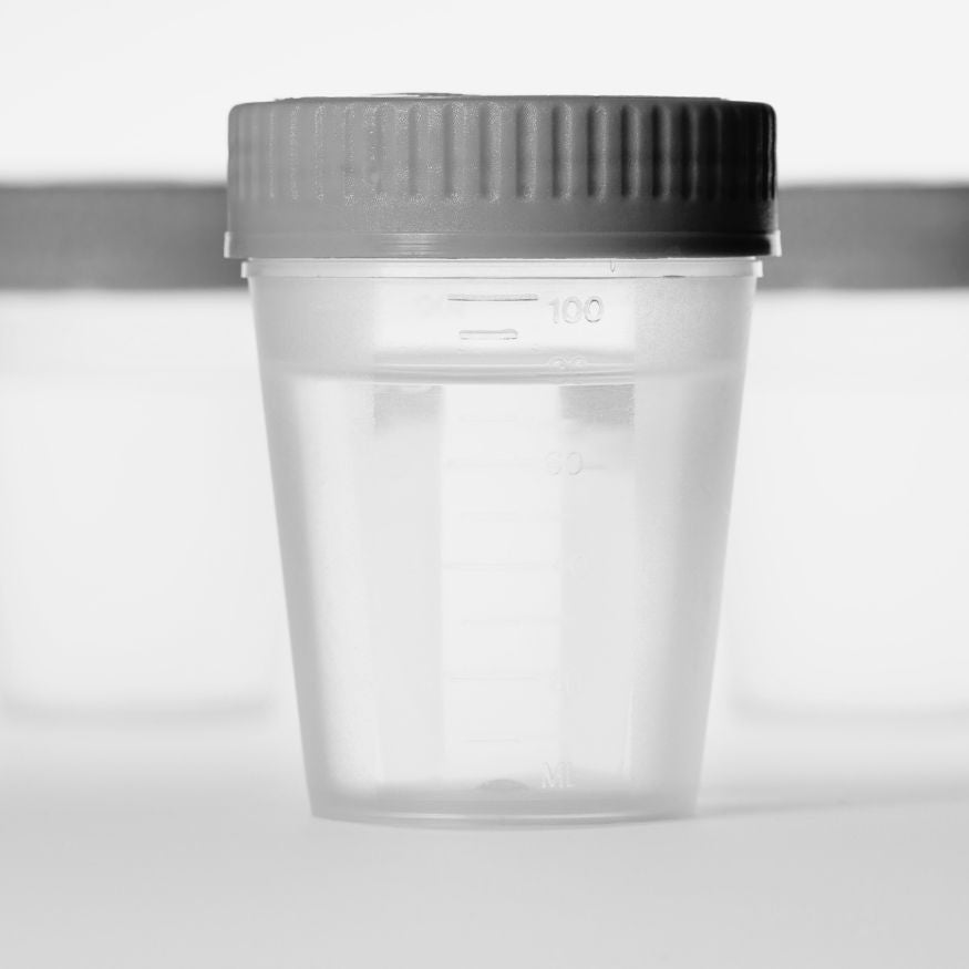 Saliva vs urine drug test kits: What’s the difference?